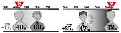 あなたの肺年齢は何歳ですか?